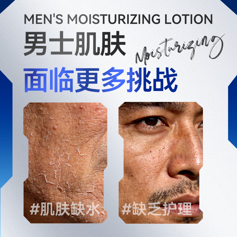 东洋之花男士保湿沁爽乳润肤露精华水护肤套装官方旗舰店 【2瓶】男士保湿沁爽乳100g*2瓶