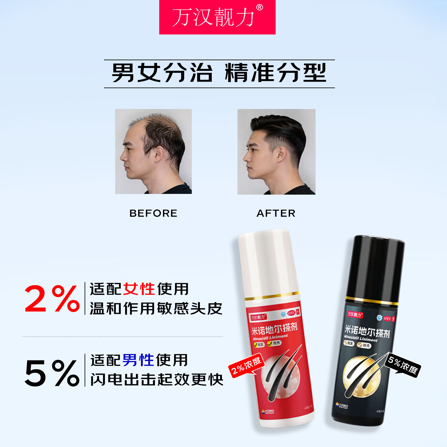 [万汉靓力]米诺地尔搽剂 5%*60ml 1盒装 5%*60ml用于治疗脱发男士专用防脱生发育发际线改善头发稀疏脱发 重度脱发体验款