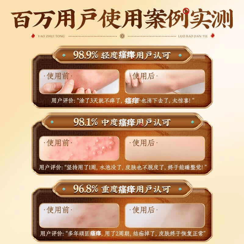 北京协和医学院湿疹膏药十大牌子皮肤瘙痒皮炎湿疹真菌感染止痒膏抑菌去顽固湿毒 特效5盒【此生不在犯】拍3发5 湿毒清去i根膏皮肤干燥瘙痒进口