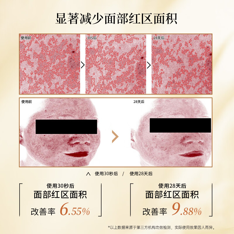 贝肤瑞修护乳霜舒缓敏感肌屏障改善泛红换季干敏补水保湿褪红面霜 咨询客服或详情页领取优惠券