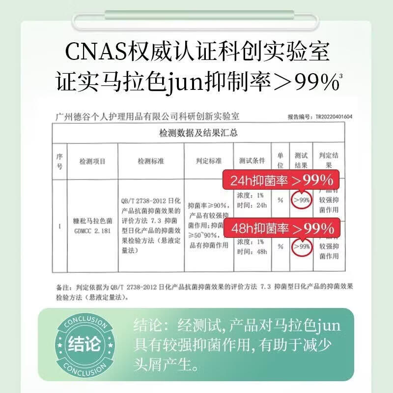阿道夫洗发水大容量洗护装去屑止痒控油蓬松轻柔丝滑净澈清爽男女士通用 轻柔丝滑洗发露300ml*1瓶