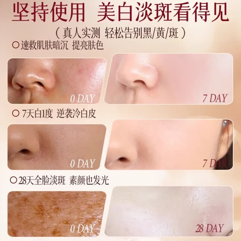 PRIVATENURSE美白祛斑霜熊果苷烟酰胺淡斑377面霜 淡化黑色素去雀斑黄褐斑提亮 1瓶装【强效去除各种斑】