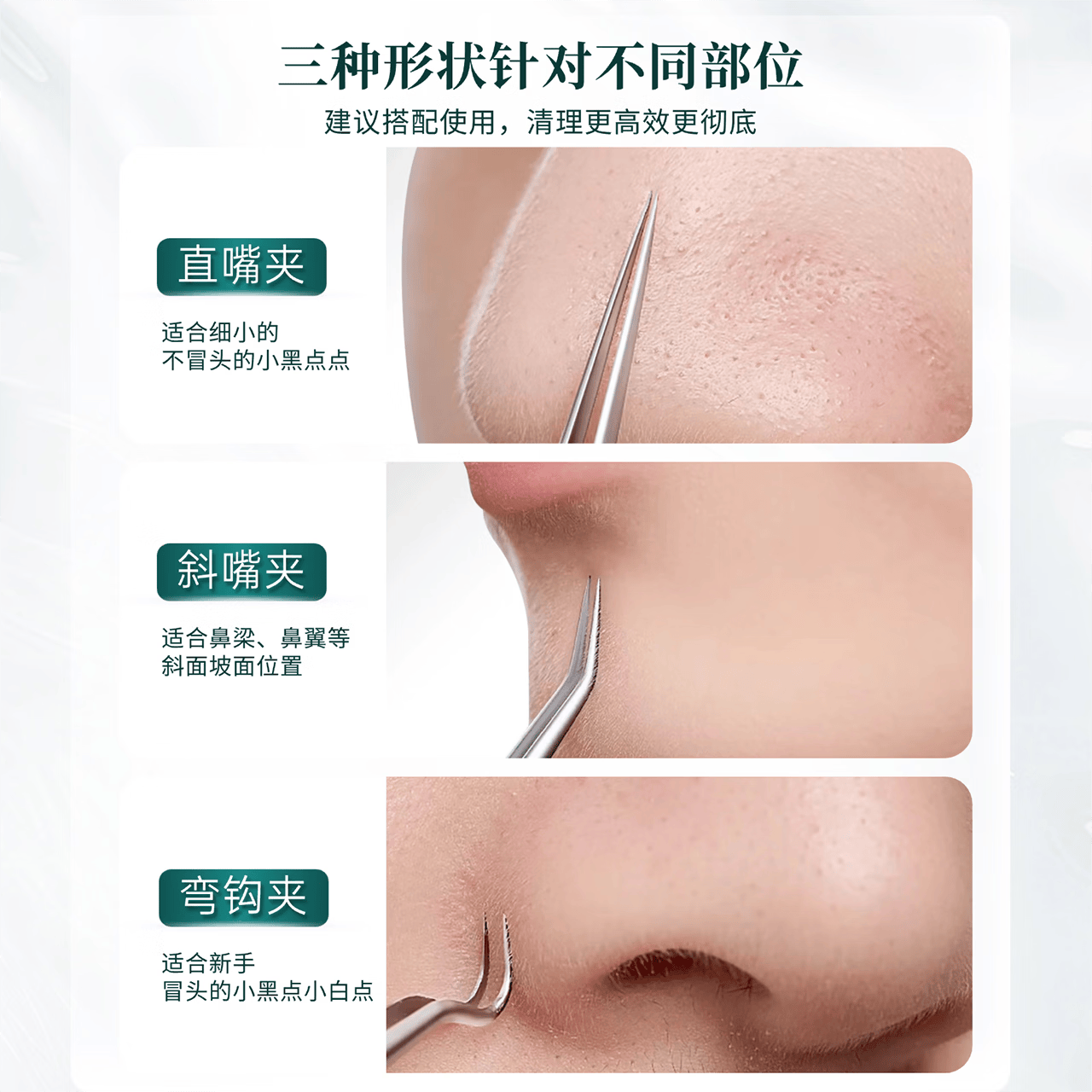 喜丽铭高精密细胞夹超细去黑头夹镊子美容院专用粉刺夹挤痘粉刺针套装 高精密细胞夹镊子I直嘴夹+弯嘴夹+粉刺针 2支 配5倍镜