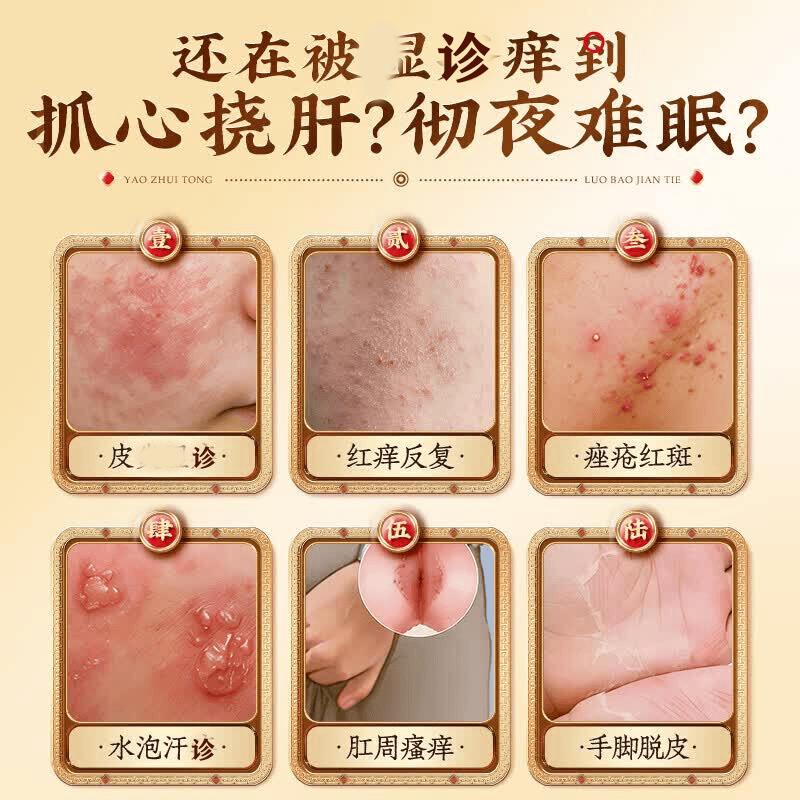 北京协和医学院湿疹膏药十大牌子皮肤瘙痒皮炎湿疹真菌感染止痒膏抑菌去顽固湿毒 特效5盒【此生不在犯】拍3发5 湿毒清去i根膏皮肤干燥瘙痒进口