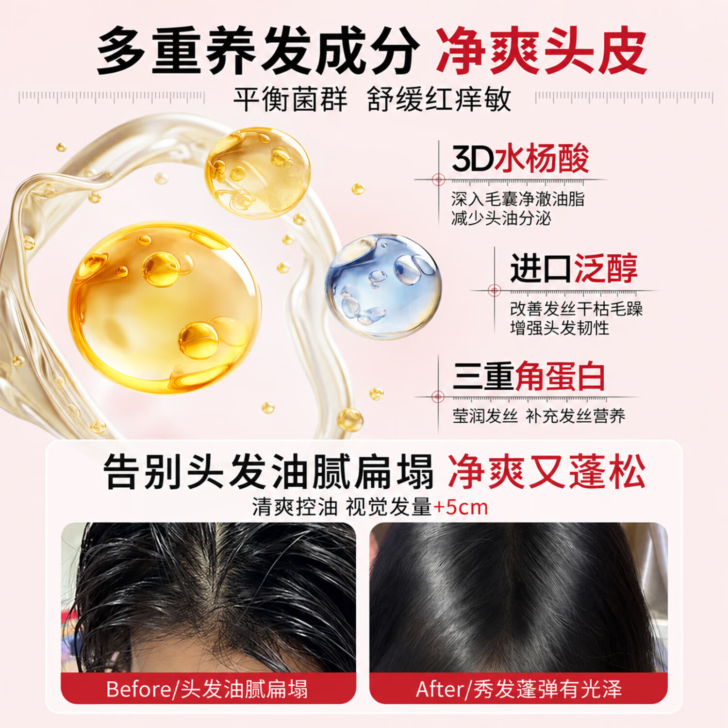 初蔓二硫化硒洗发水男女士专用去屑止痒控油持久蓬松洗头膏露榜金第1 【医研配比】二硫化硒洗发水600ml*1