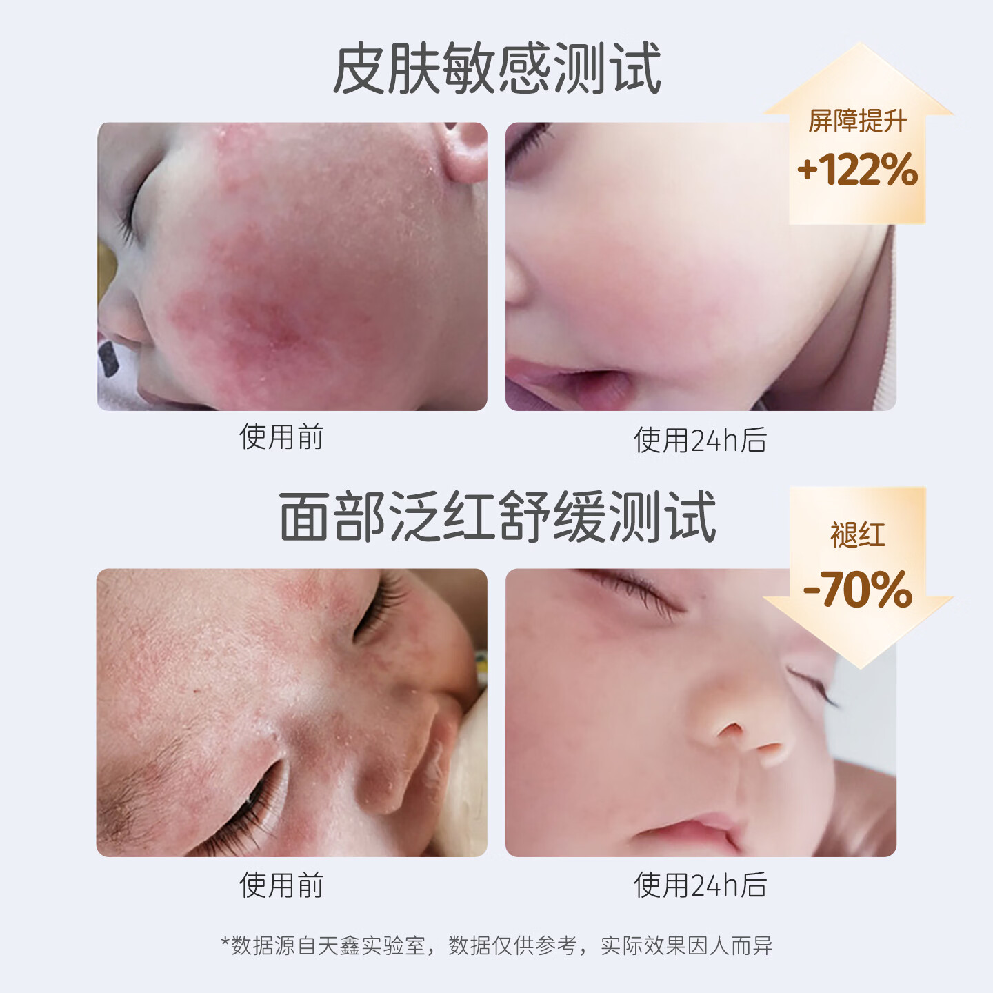 松达特护霜婴儿舒缓面霜滋润保湿宝宝亚麻籽油擦脸霜护肤口水膏润肤霜 婴儿臻护倍润霜68g*2瓶