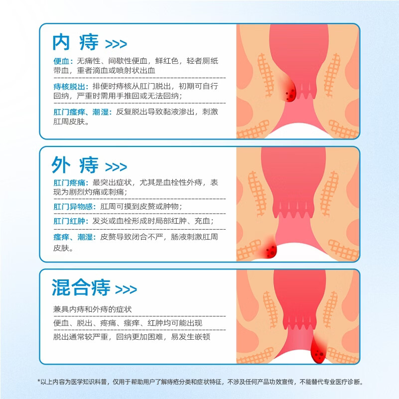 润坦宁医用生物凝胶敷料II型内痔肛门瘙痒灼痛疼痛脱垂 3盒 9支【内痔 混合痔 瘙痒 灼痛】