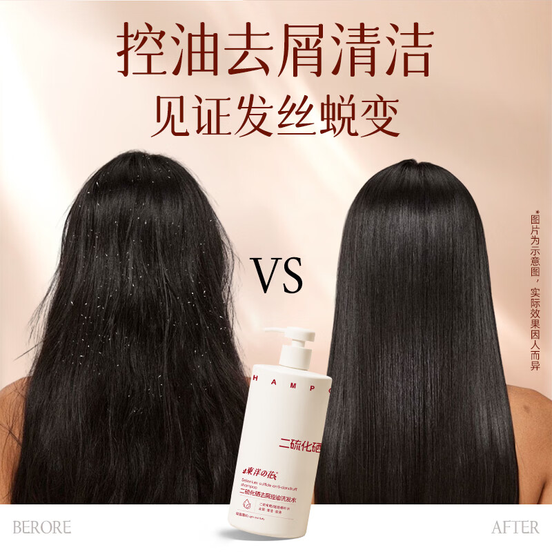 东洋之花二硫化硒洗发水男士女士缓解头痒去屑控油持久留香母亲节礼物 【控油去屑套装】东洋之花二硫化硒洗发水蓬松500ml*2