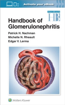 预订 handbook of glomerulonephritis