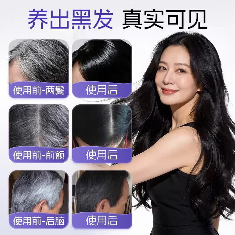 卡西奈维生素b黑发卡西奈维生素b片中老年黑发白发滋养发根毛囊官方正品 周期装【中度白发】 60粒*3盒