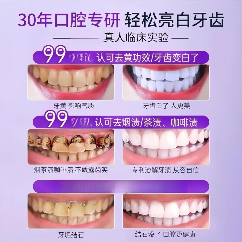 colugea溶菌酶亮白牙膏深层清洁牙渍牙垢美白牙齿持久清新口气护齿牙膏 溶菌酶亮白牙膏100g*5支【买3赠2】