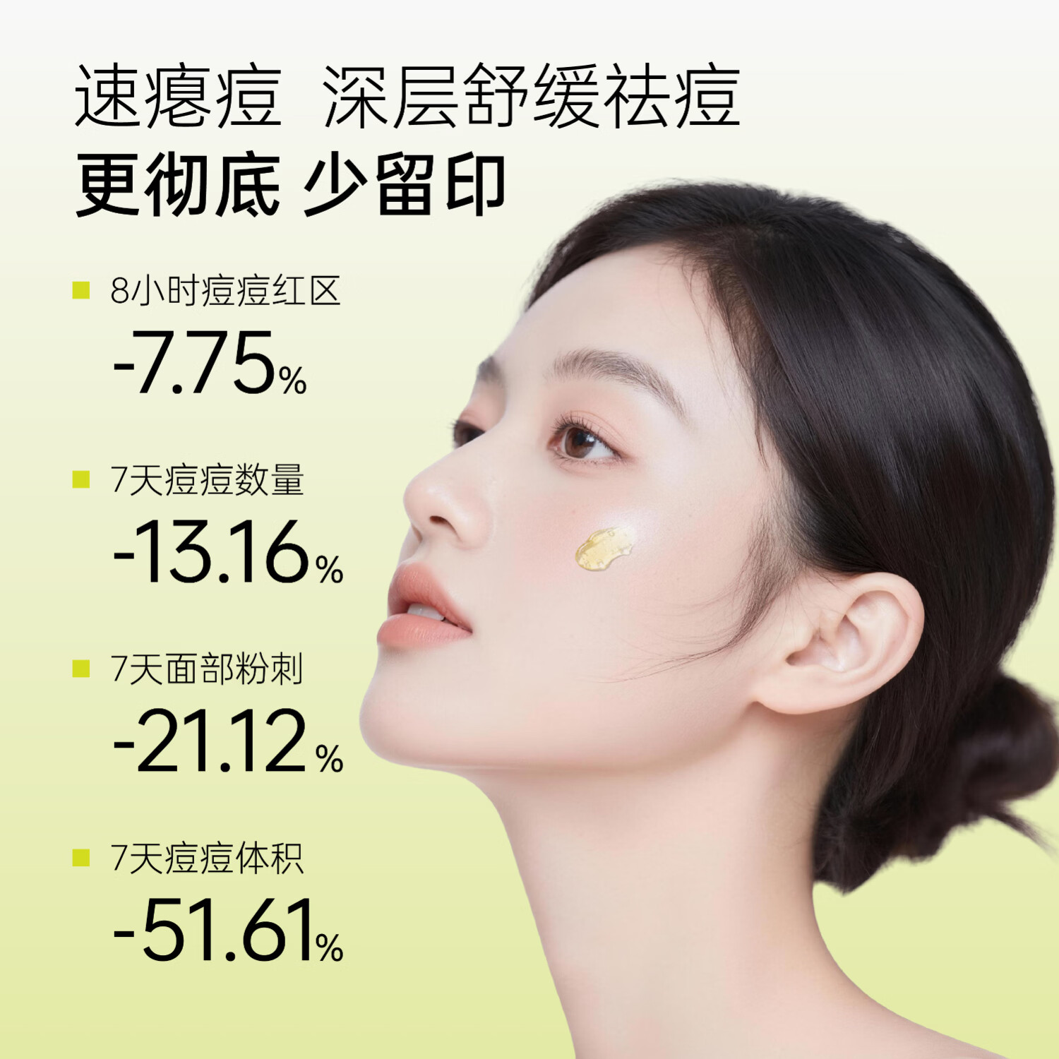 纳茵美重组蛋白祛痘凝胶速祛痘褪红姨妈痘男女青春痘祛痘精华 【拍1发5】重组胶原祛痘凝胶30g