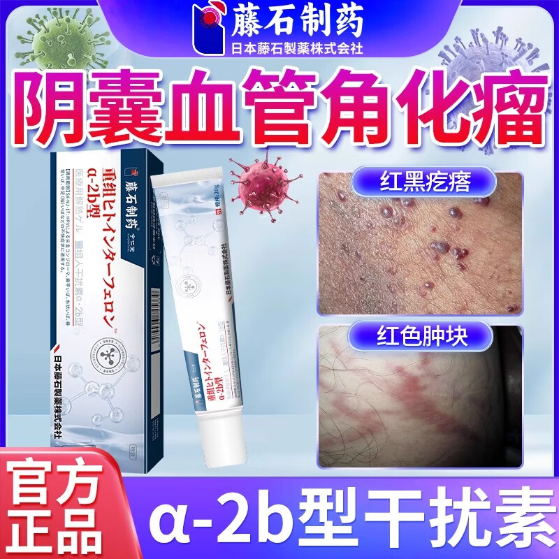 阴囊血管角化瘤血管痣蜘蛛痣睾丸红斑潮湿丘疹表皮瘙痒粗糙疼痛角皮瘤