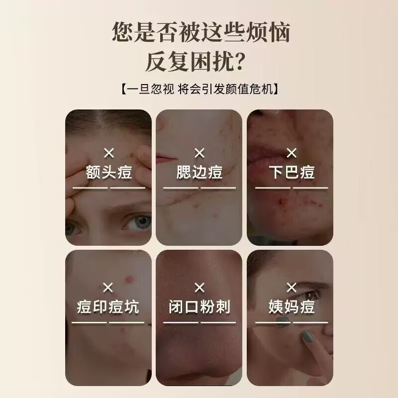 七子白洁面皂清洁焕肤控油去黑头毛孔闭口除螨去背痘香皂 1盒