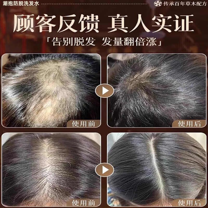 京东线上商城生姜侧柏叶防脱育发洗发水中药控油密发增发同款代购 两瓶装[针对严重脱发]4周见新发
