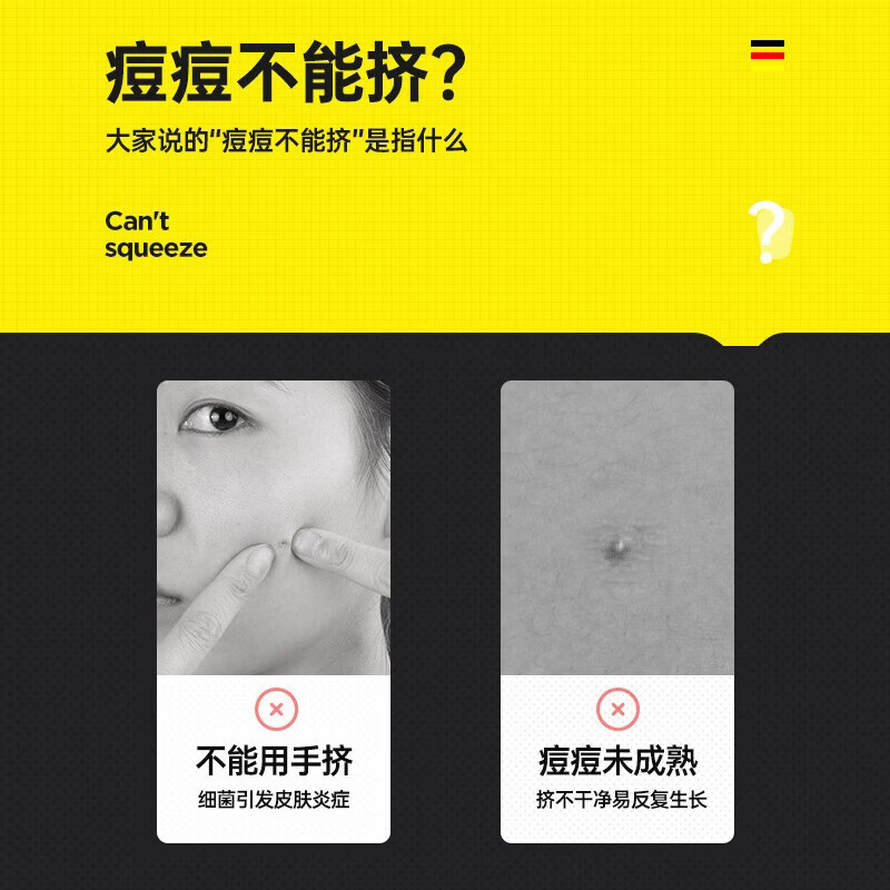 海菲诺粉刺针套装挤痘痘针暗疮针去黑头针挑痘清痘针细胞夹套装 【银色】粉刺针套装 4件