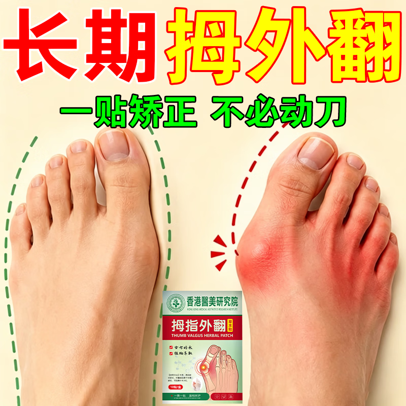 拇指外翻贴膏药大脚骨外翻拇囊炎大脚趾矫正神器关节胀痛专用膏药 100%特效:买3送2 【必冶好】.