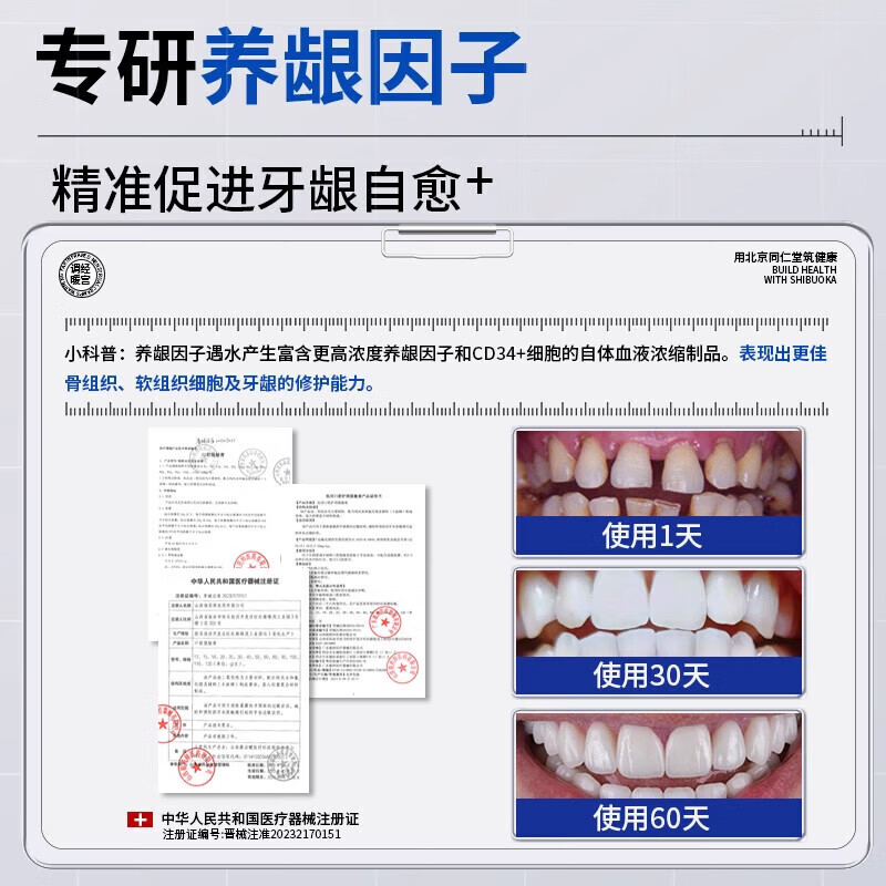 速克欧牙膏去牙结石溶解美白除牙垢速清理有效脱敏牙周i炎口腔肿 1支【装】建多盒更实惠 品牌直售