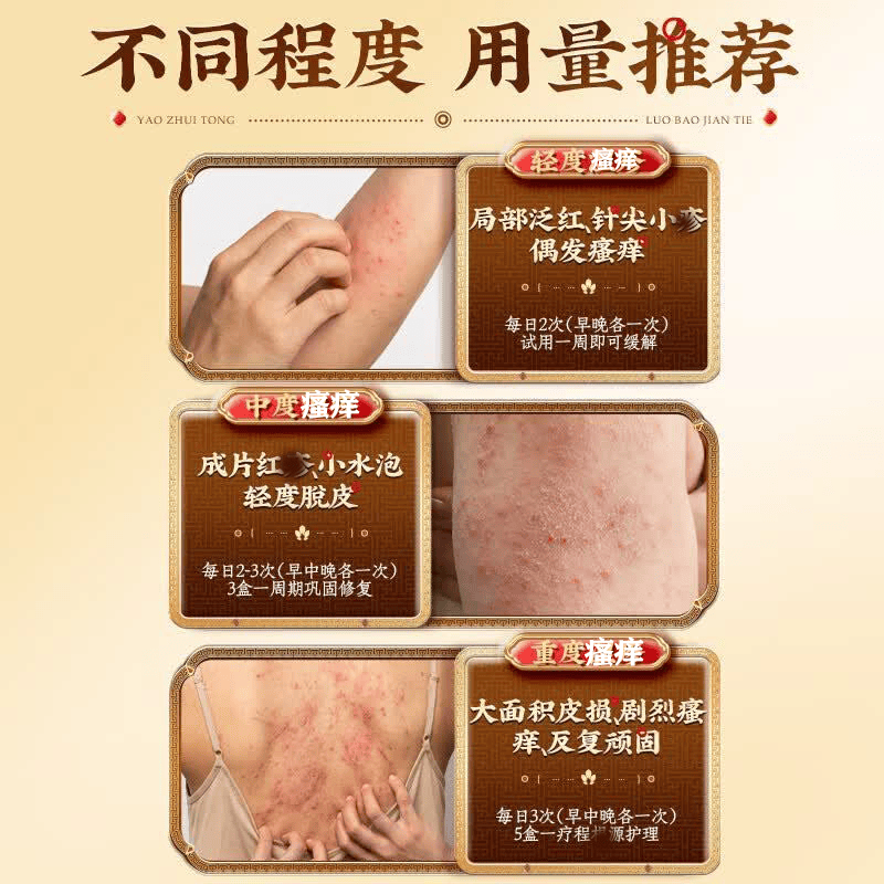 北京协和医学院湿疹膏药十大牌子皮肤瘙痒皮炎湿疹真菌感染止痒膏抑菌去顽固湿毒 特效5盒【此生不在犯】拍3发5 湿毒清去i根膏皮肤干燥瘙痒进口