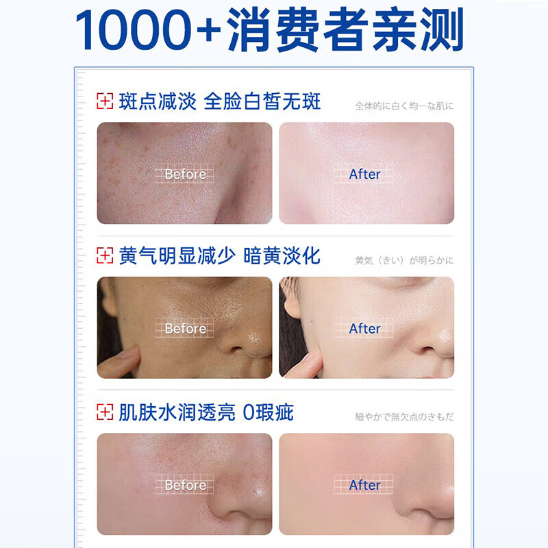 DWDS烟酰胺凝胶身体护理医用级100%原液去黄气美白祛色斑 4支周期装【去黄提亮淡色斑】