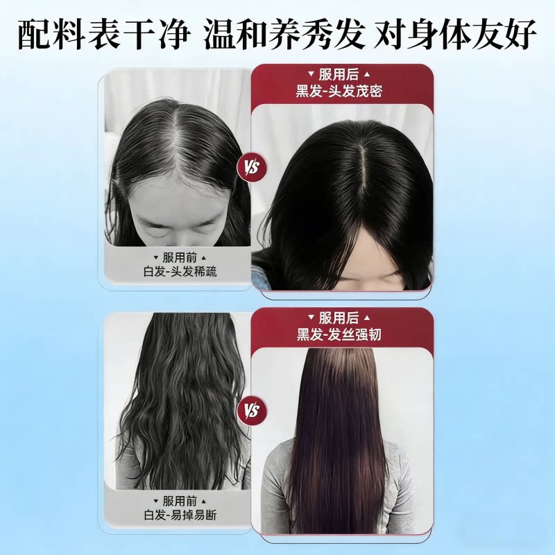 DWDS【官方正品】卡西耐卡西奈维生素B卡西奈鱼油白发调理精华乌黑素 官方正品【巩固装】 60片*3盒 京东官方大药房