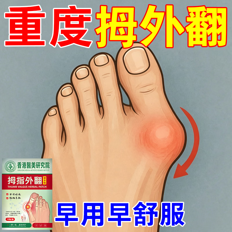 拇指外翻贴膏药大脚骨外翻拇囊炎大脚趾矫正神器关节胀痛专用膏药 100%特效:买3送2 【必冶好】. 京东折扣/优惠券