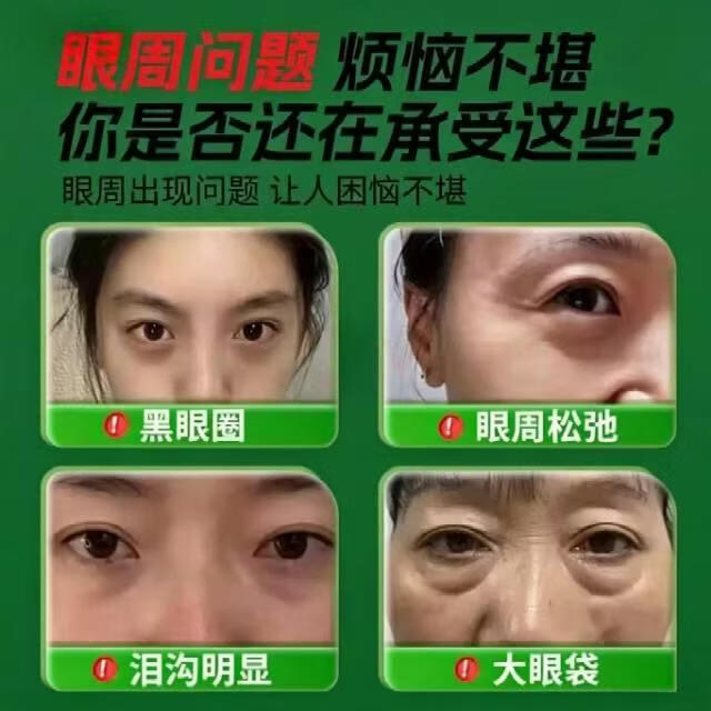 SKALL中药草本人参虫草眼霜紧致抗皱逆颜淡化黑眼圈熬夜细纹大眼袋提拉 【买二送一】到手3瓶【解决各种眼部问题】