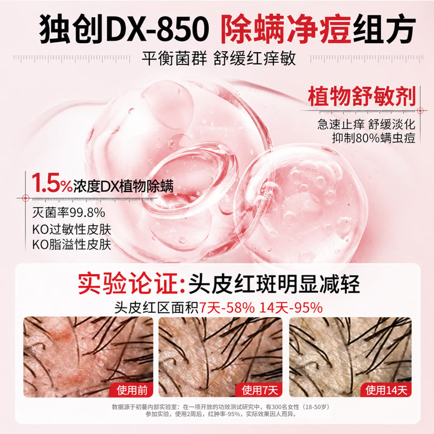 初蔓二硫化硒洗发水男女士专用去屑止痒控油持久蓬松洗头膏露榜金第1 【医研配比】二硫化硒洗发水600ml*1