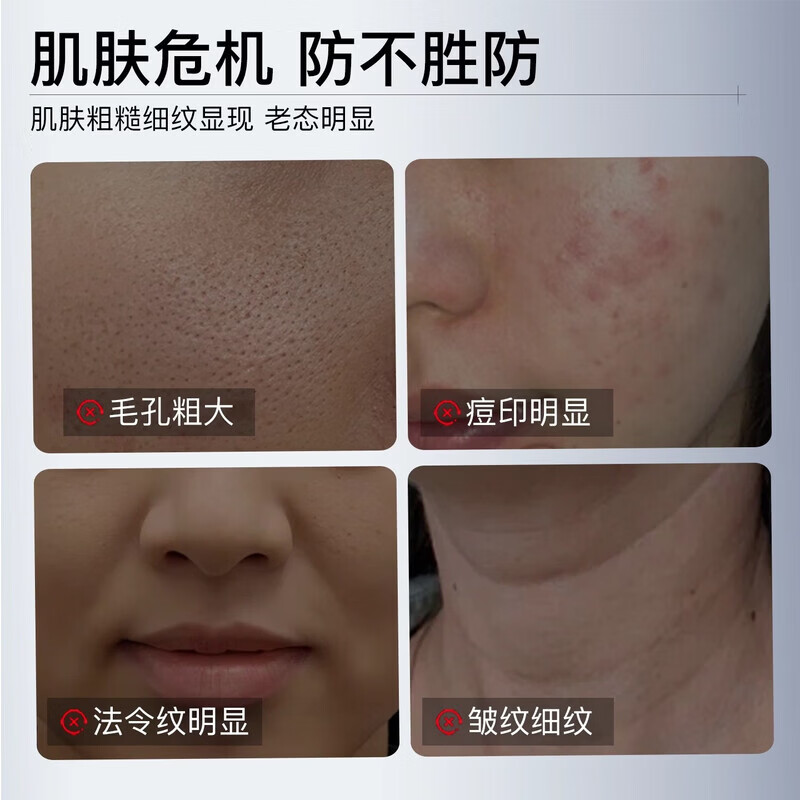 通用HSZ护理膜FXZ蛋白敷料QXE护理膜QXE胶原蛋白医用重组胶原蛋白凝胶 1盒装【体验装】HSZ护理膜