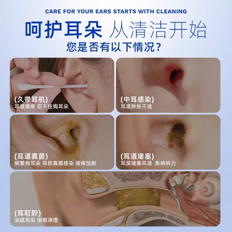 苗先锋硼酸酒精滴耳液硼酸甘油中耳朵痒清理神器耳康洗耳液溶剂人用 苗先锋-硼酸滴耳液20ml