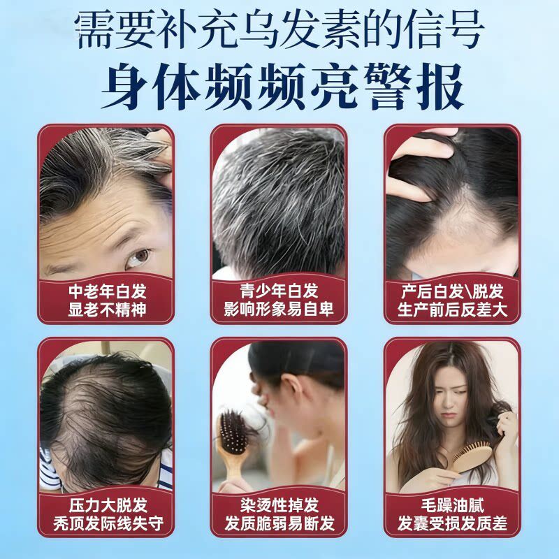 DWDS【官方正品】卡西耐卡西奈维生素B卡西奈鱼油白发调理精华乌黑素 官方正品【巩固装】 60片*3盒 京东官方大药房
