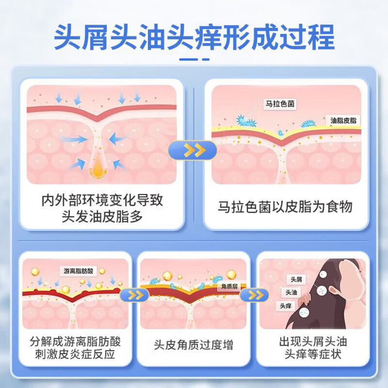 希尔生二硫化硒洗发液2.5%洗剂医用毛囊炎脂溢性皮炎皮炎花斑癣汗斑 3盒装 【脓包结痂 马拉色菌】 希尔生二硫化硒洗发液2.5%