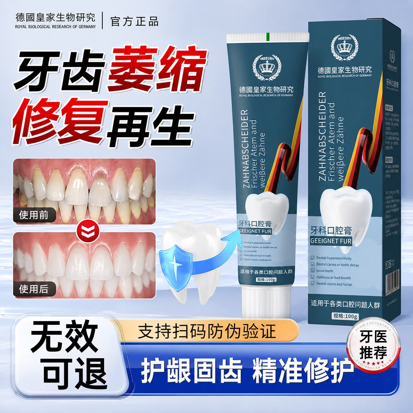 SOVIP德国牙膏护龈固齿牙龈I萎缩修复再I生牙根外露牙周I炎牙齿I松动 【牙龈养护体验装】1支