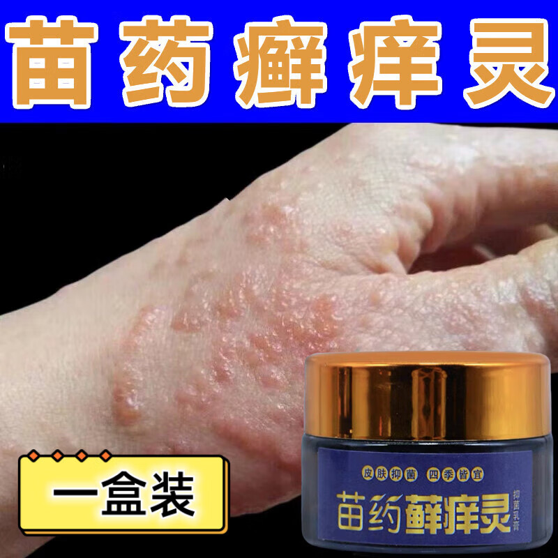 苗药癣痒灵草本乳膏御夫王止痒软膏 一盒体验装