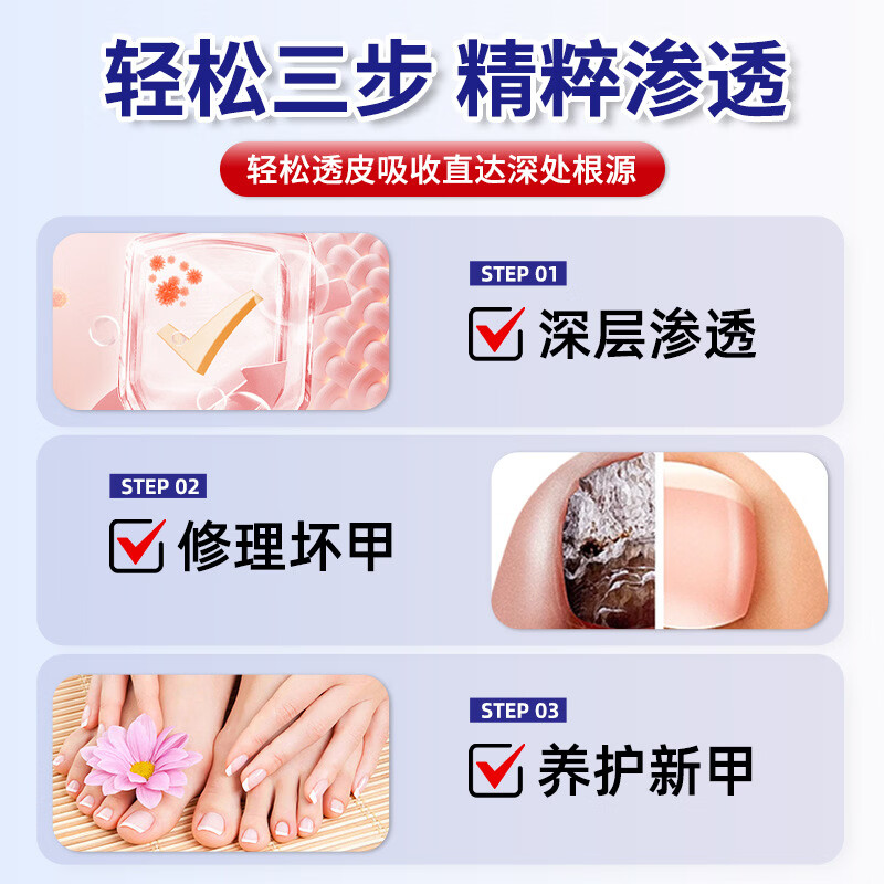 凤仙花官方旗舰店凤仙花灰指甲外用灰甲贴套装保健温和吸收草本精华 清爽舒适【50g*2+50g】