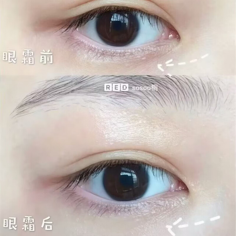 资生堂（Shiseido）新版悦薇眼霜纯A小针管小雷达质感塑颜亢皱霜淡纹亢老紧致20ml 【新品】小雷达眼霜15ml