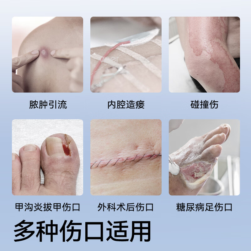 振德(ZHENDE)凡士林纱布医用无菌独立包装脱脂棉伤口防粘敷料创口烧烫伤包扎 【细砂|5*5】凡士林纱布15片 灭菌