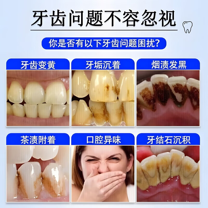 南京同仁堂抑菌去口臭祛去黄去牙渍去烟渍牙垢口气重嘴巴臭口腔异味克星 买3送2【重度口臭】