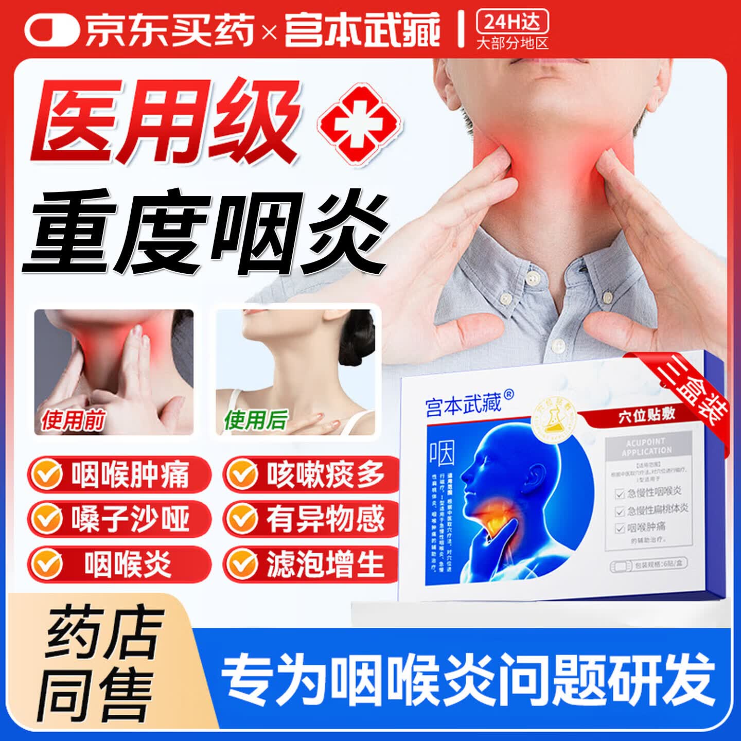 宫本武藏咽喉炎专用膏药贴慢性咽炎喉咙痒干咳咽喉肿痛有异物感扁桃体发炎