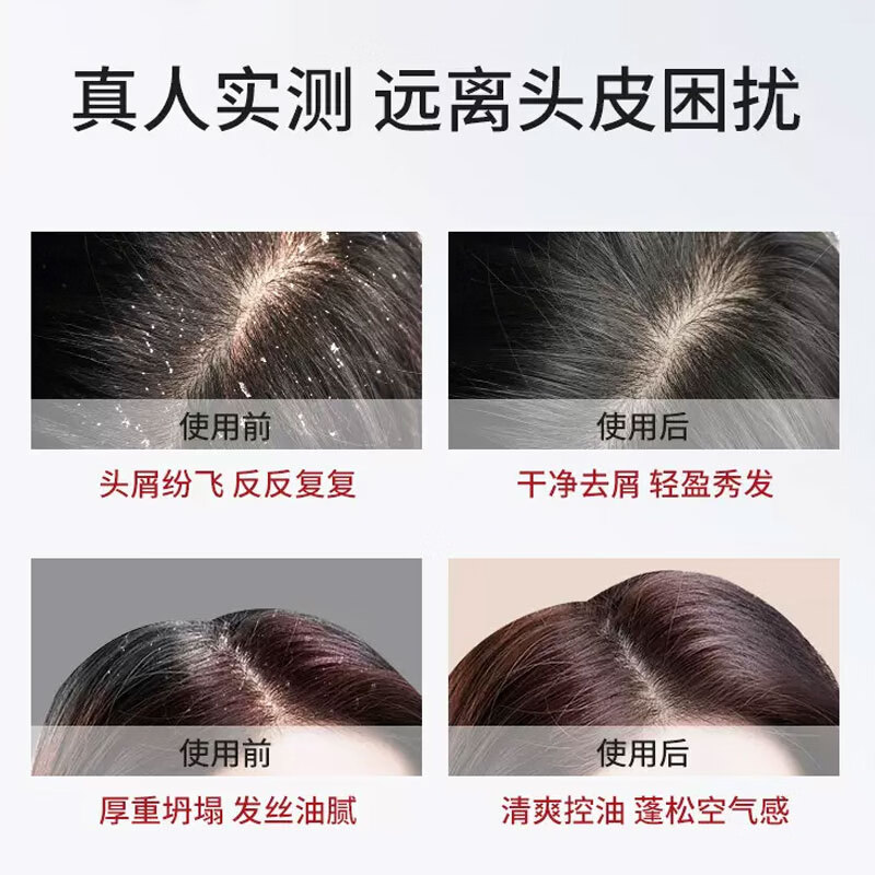 仲夏青春洗发水去屑控油洗发露舒缓二硫化硒洗发水去屑止痒舒缓洗发水 二硫化硒去屑洗发露*2瓶/