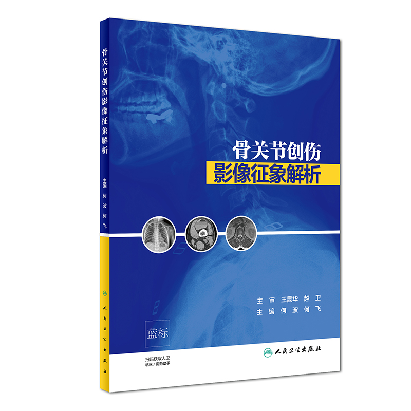 骨关节创伤影像征象解析（培训教材）