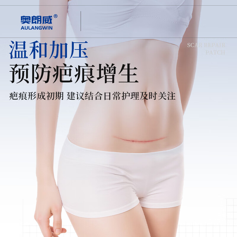 奥朗威日抛硅凝胶疤痕贴剖腹产增生手术疤痕剖宫产疤痕长期护理 日抛30天装 短期护理【呵护新生疤痕】