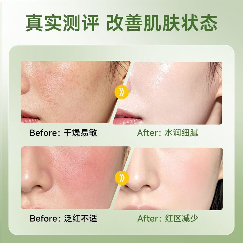 法汀妮积雪草b5乳液面膜抗皱紧致保湿改善熬夜松垮暗沉面膜礼物 【逆袭嘭弹少女肌】积雪草b5乳液面膜30片/3盒