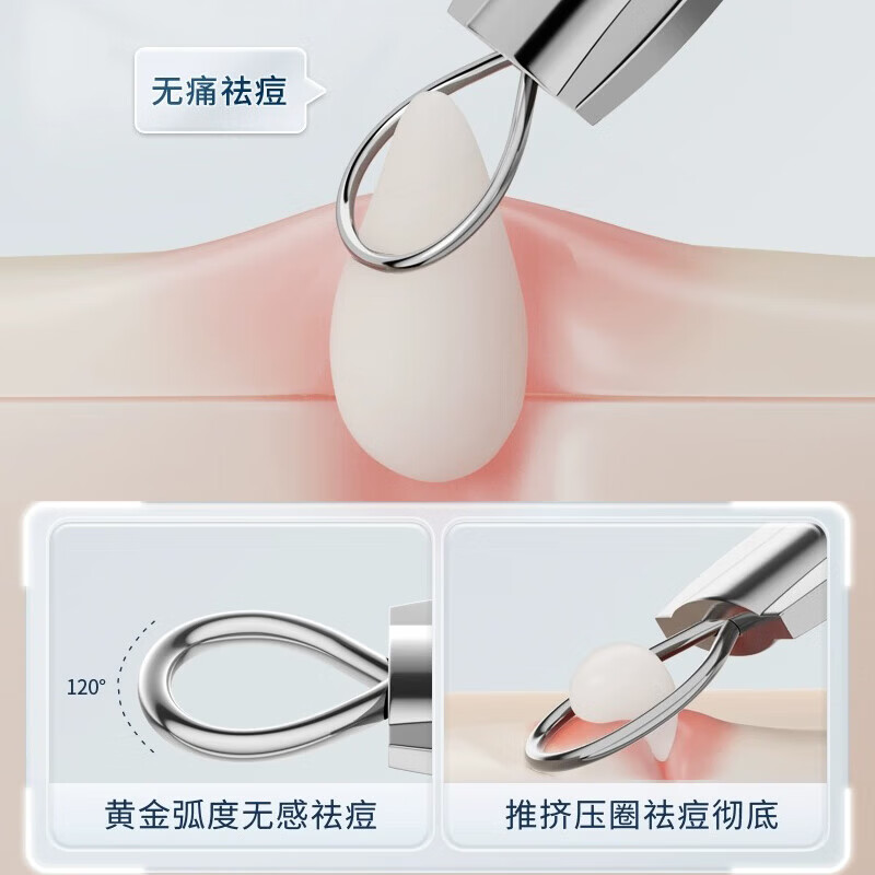 海菲诺粉刺针套装挤痘痘针暗疮针去黑头针挑痘清痘针细胞夹套装 【银色】粉刺针套装 4件