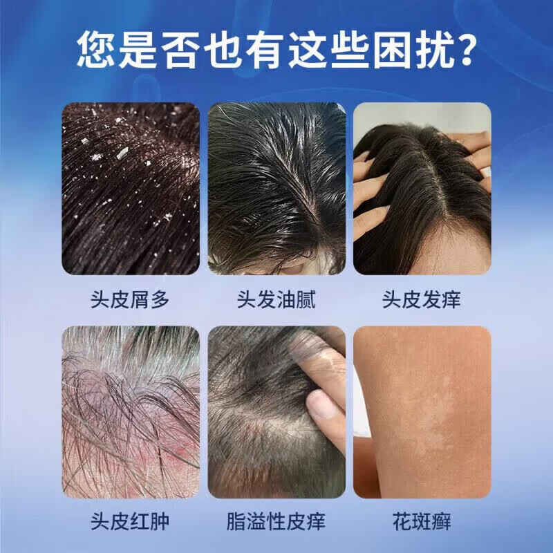 希尔生二硫化硒洗发液2.5%洗剂医用毛囊炎脂溢性皮炎皮炎花斑癣汗斑 3盒装 【脓包结痂 马拉色菌】 希尔生二硫化硒洗发液2.5%