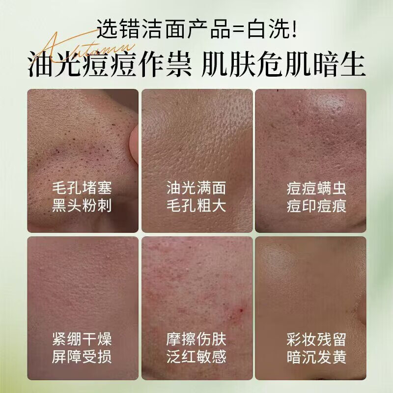 离岛日记洗面奶植仆洁面乳补水保湿滋润淡化色斑雀斑清洁控油 一盒装【体验装】