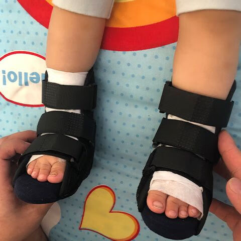 医用宝宝内八字矫正鞋马蹄足内翻脚部脚踝儿童夜用骨折康复腿部