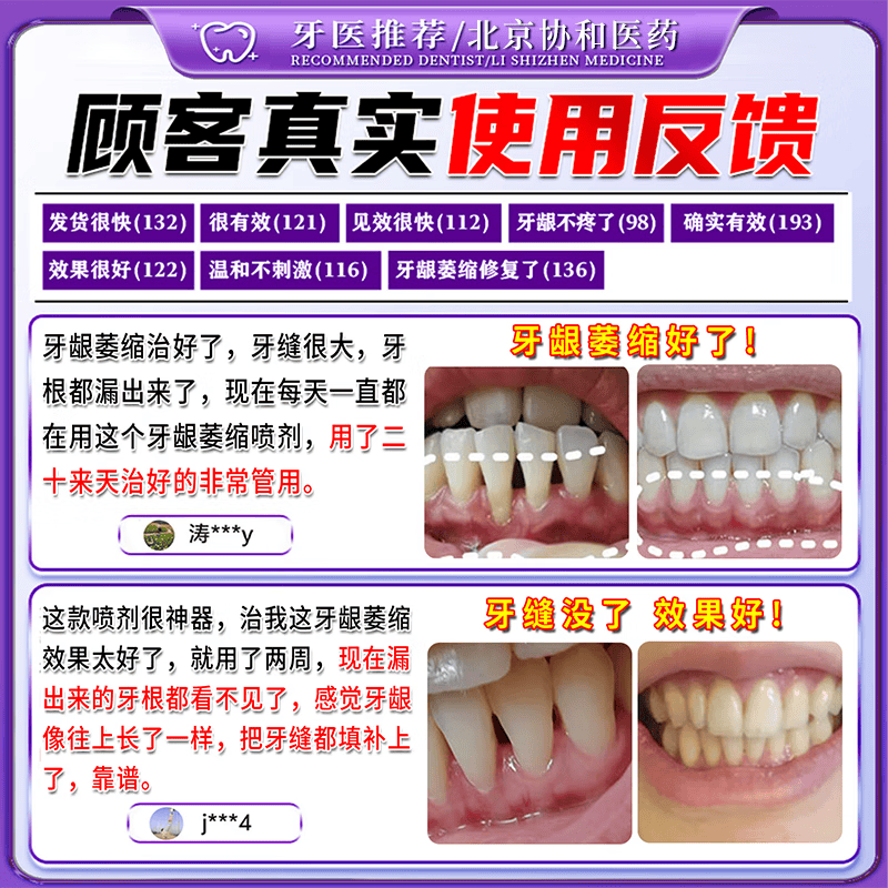 北京协和医学院萎缩牙龈i牙膏修复再生牙根外露专用牙膏护龈固齿牙龈i萎缩再生 【牙龈萎缩牙膏】一盒 舒适达牙龈修复萎缩抗过敏松动