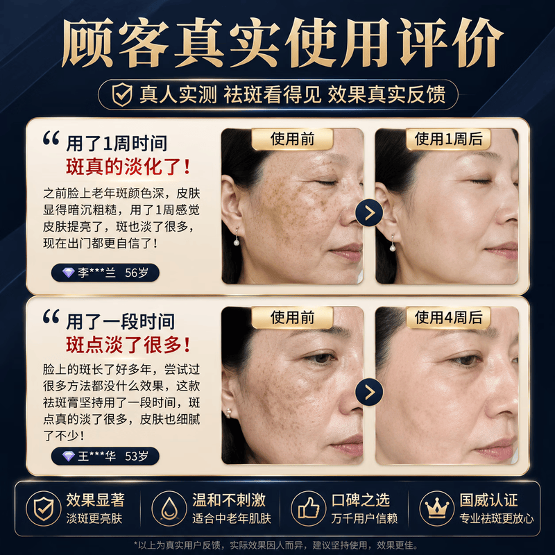 北京协和医学院祛斑霜老年斑专用特效非药一夜消去老年斑男士专用的药脸部手背 特效1盒装【北京协和】祛斑点斑专用的药水医用级 医用美白祛斑霜淡化黑色素去雀斑黄褐斑正品