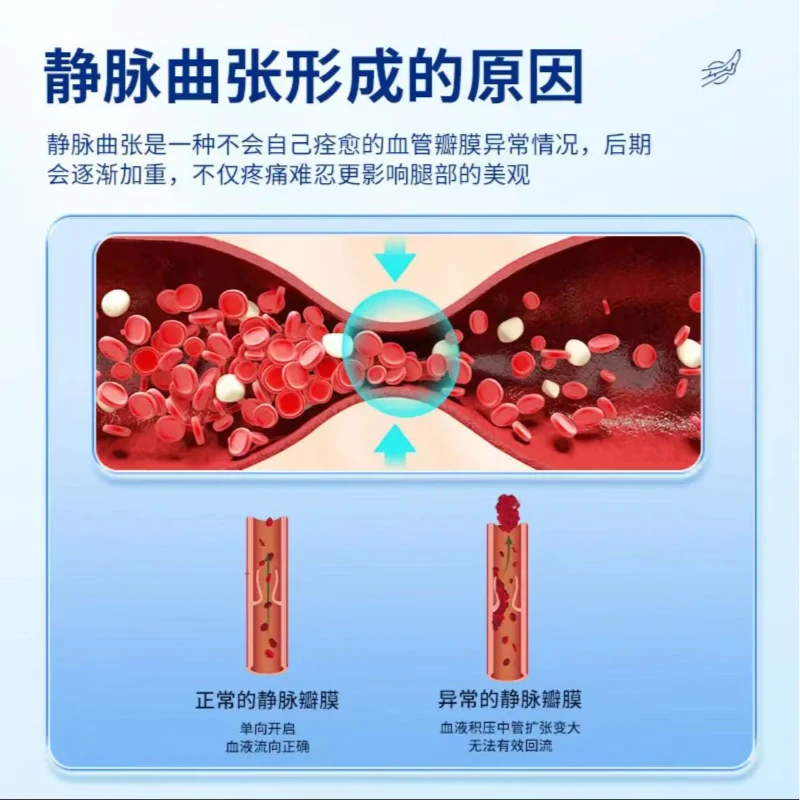 内廷上用堂静脉曲张退热凝胶药膏蚯蚓腿腿部血管变形腿疼酸麻肿胀 1个*1盒 【初期调理】